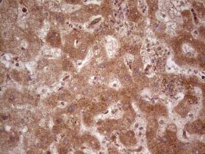Immunohistochemistry: UbcH5b/UBE2D2 Antibody (OTI2C2) - Azide and BSA Free [NBP2-74732]