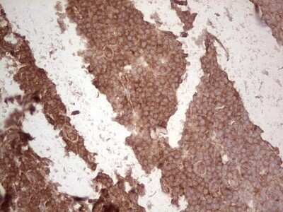 Immunohistochemistry: UbcH5b/UBE2D2 Antibody (OTI2C2) - Azide and BSA Free [NBP2-74732]