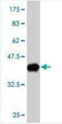 Western Blot: UbcH5c/UBE2D3 Antibody (4C1-1E3) [H00007323-M01]