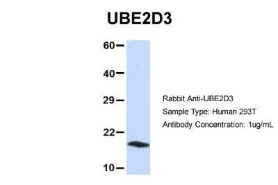 Western Blot: UbcH5c/UBE2D3 Antibody [NBP1-55276]