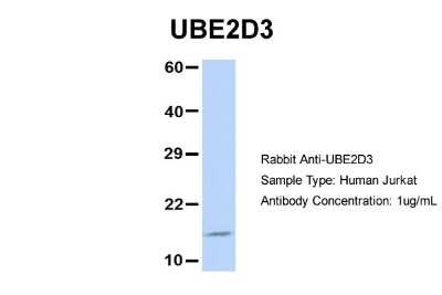 Western Blot: UbcH5c/UBE2D3 Antibody [NBP1-55276]