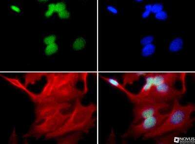 Immunocytochemistry/ Immunofluorescence: UbcH6/UBE2E1 Antibody - BSA Free [NBP1-78983]