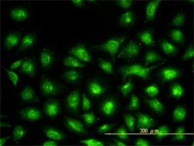 Immunocytochemistry/ Immunofluorescence: UbcH7/UBE2L3 Antibody (3B7) [H00007332-M01]