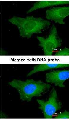 Immunocytochemistry/ Immunofluorescence: UbcH7/UBE2L3 Antibody [NBP1-30995]