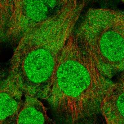 Immunocytochemistry/ Immunofluorescence: UbcH7/UBE2L3 Antibody [NBP2-49367]