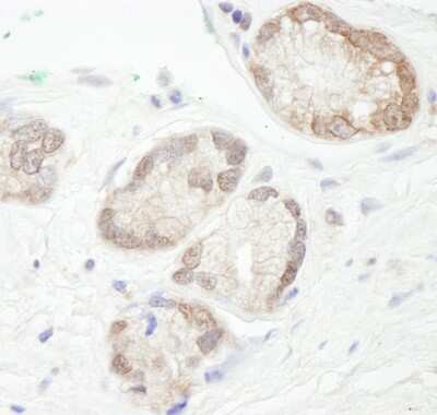 Immunohistochemistry-Paraffin: UbcH7/UBE2L3 Antibody [NB100-2265]