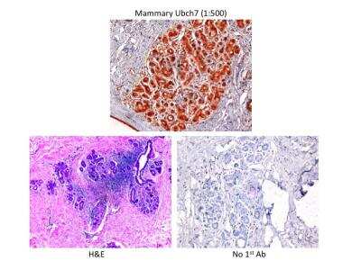 Immunohistochemistry-Paraffin: UbcH7/UBE2L3 Antibody [NB100-2265]