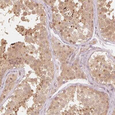 Immunohistochemistry-Paraffin: UbcH7/UBE2L3 Antibody [NBP2-49367]