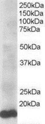 Western Blot: UbcH7/UBE2L3 Antibody [NB300-841]