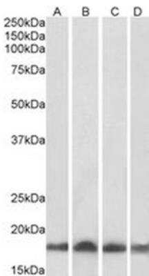 Western Blot: UbcH7/UBE2L3 Antibody [NB300-841]