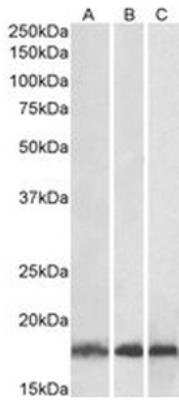 Western Blot: UbcH7/UBE2L3 Antibody [NB300-841]