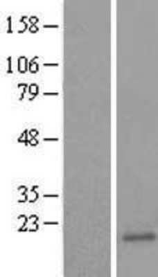 Western Blot: HR6B/UBE2B Overexpression Lysate [NBL1-17513]