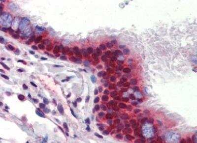 Immunohistochemistry-Paraffin: Ubiquilin 1 Antibody [NBP1-56536]
