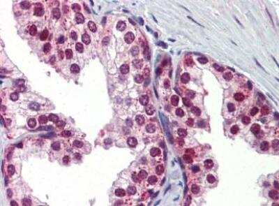 Immunohistochemistry-Paraffin: Ubiquilin 1 Antibody [NBP1-56536]
