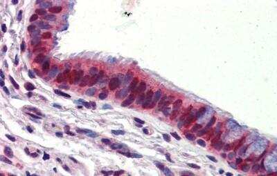 Immunohistochemistry-Paraffin: Ubiquilin 1 Antibody [NBP1-56536]