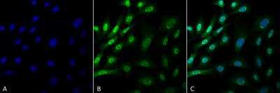 Immunocytochemistry/ Immunofluorescence: Ubiquitin Antibody (FK1) [NBP3-11039]