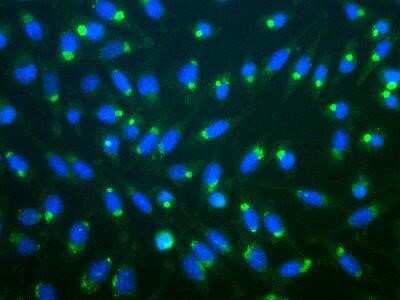Immunocytochemistry/ Immunofluorescence: Ubiquitin Antibody [NB300-129]