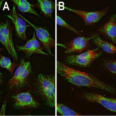 Immunocytochemistry/ Immunofluorescence: Ubiquitin Antibody [NB300-129]