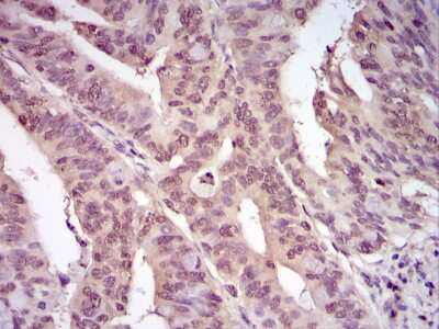 Immunohistochemistry-Paraffin: Ubiquitin Antibody [NB300-129]
