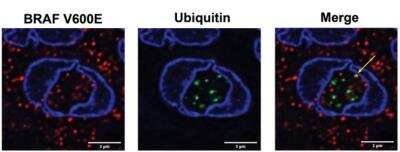 Immunocytochemistry/ Immunofluorescence: Ubiquitin Antibody (Ubi-1) [NB300-130]