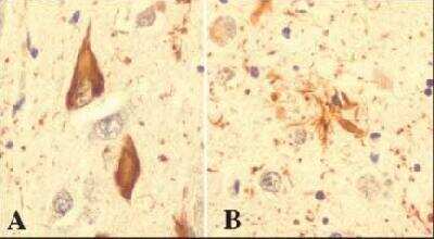 Immunohistochemistry-Paraffin: Ubiquitin Antibody (Ubi-1) [NB300-130]