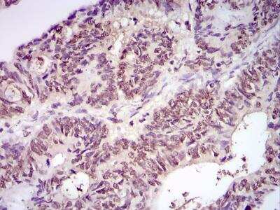 Immunohistochemistry-Paraffin: Ubiquitin Antibody (Ubi-1) [NB300-130]