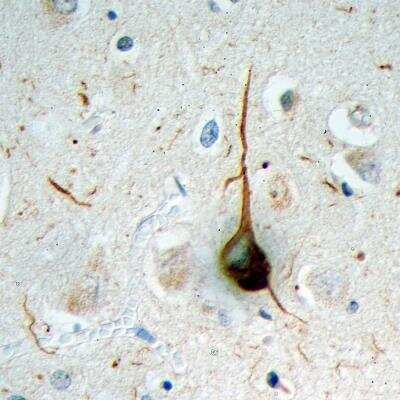 Immunohistochemistry-Paraffin: Ubiquitin Antibody (Ubi-1) [NB300-130]