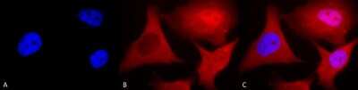 Immunocytochemistry/ Immunofluorescence: Ubiquitin B Antibody (6C11-B3) [NBP2-12882]