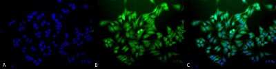 Immunocytochemistry/ Immunofluorescence: Ubiquitin B Antibody (6C11-B3) [NBP2-12882]
