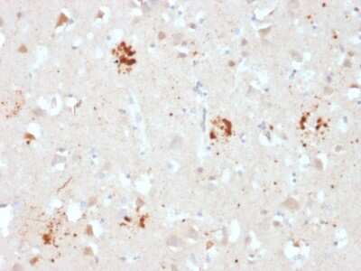 Immunohistochemistry-Paraffin: Ubiquitin B Antibody (UBB/2122) - Azide and BSA Free [NBP3-08906]