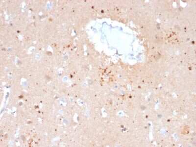 Immunohistochemistry-Paraffin: Ubiquitin B Antibody (UBB/2122) - Azide and BSA Free [NBP3-08906]