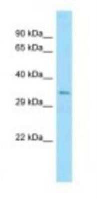 Western Blot: Ubiquitin B Antibody [NBP1-98436]