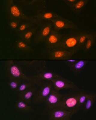 Immunocytochemistry/ Immunofluorescence: Ubiquitin-activating Enzyme/UBE1 Antibody (6H2I9) [NBP3-16792]