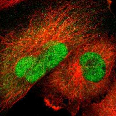 Immunocytochemistry/ Immunofluorescence: Ubiquitin-activating Enzyme/UBE1 Antibody [NBP2-76500]