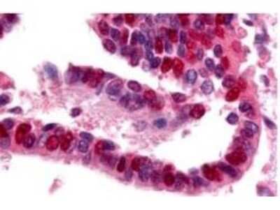 Immunohistochemistry: Ubiquitin-activating Enzyme/UBE1 Antibody [NB600-472]