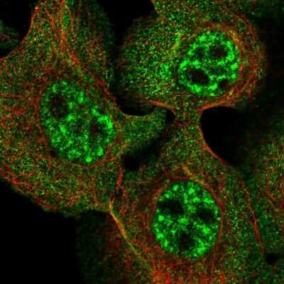 Immunocytochemistry/ Immunofluorescence: Ufc1 Antibody [NBP1-81676]