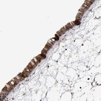 Immunohistochemistry-Paraffin: Ufc1 Antibody [NBP1-81676]