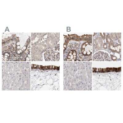 Immunohistochemistry-Paraffin: Ufc1 Antibody [NBP1-81676]