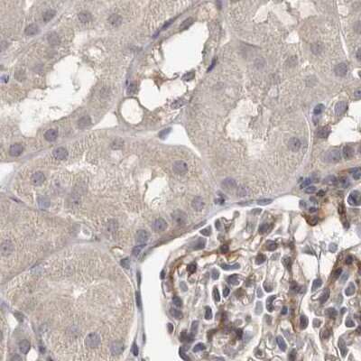 Immunohistochemistry-Paraffin: Ufc1 Antibody [NBP1-81676]