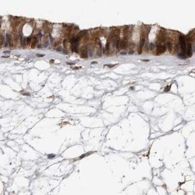 Immunohistochemistry-Paraffin: Ufc1 Antibody [NBP1-81676]