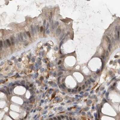 Immunohistochemistry-Paraffin: Ufc1 Antibody [NBP1-81676]