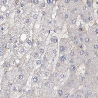 Immunohistochemistry-Paraffin: Ufc1 Antibody [NBP1-81676]