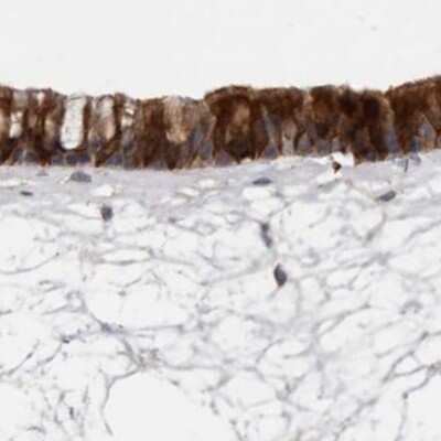 Immunohistochemistry-Paraffin: Ufc1 Antibody [NBP1-81677]