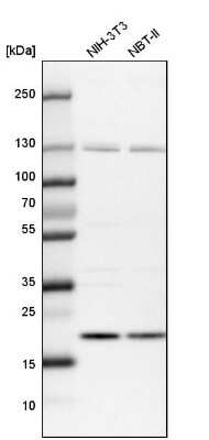 Western Blot: Ufc1 Antibody [NBP1-81676]