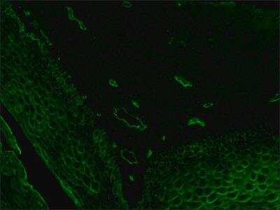 Immunohistochemistry: Ulex Europaeus Lectin 1 Antibody [NB110-13922]