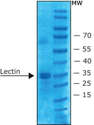 SDS-PAGE: Ulex Europaeus Lectin 1 Native Protein [NBP2-42700]