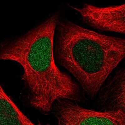 Immunocytochemistry/ Immunofluorescence: Uridine Phosphorylase 1/UPP1 Antibody [NBP2-30852]