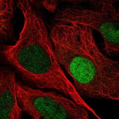 Immunocytochemistry/ Immunofluorescence: Uridine Phosphorylase 1/UPP1 Antibody [NBP2-58229]