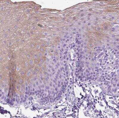 Immunohistochemistry-Paraffin: Uridine Phosphorylase 1/UPP1 Antibody [NBP2-30852]