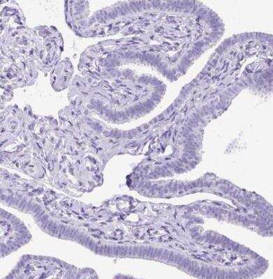 Immunohistochemistry-Paraffin: Uridine Phosphorylase 1/UPP1 Antibody [NBP2-30852]